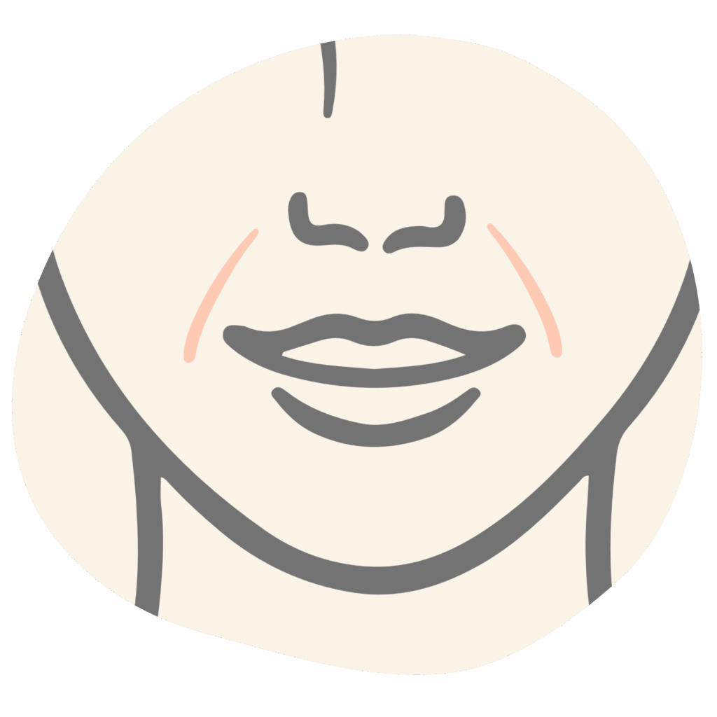Nasollabialfalte
