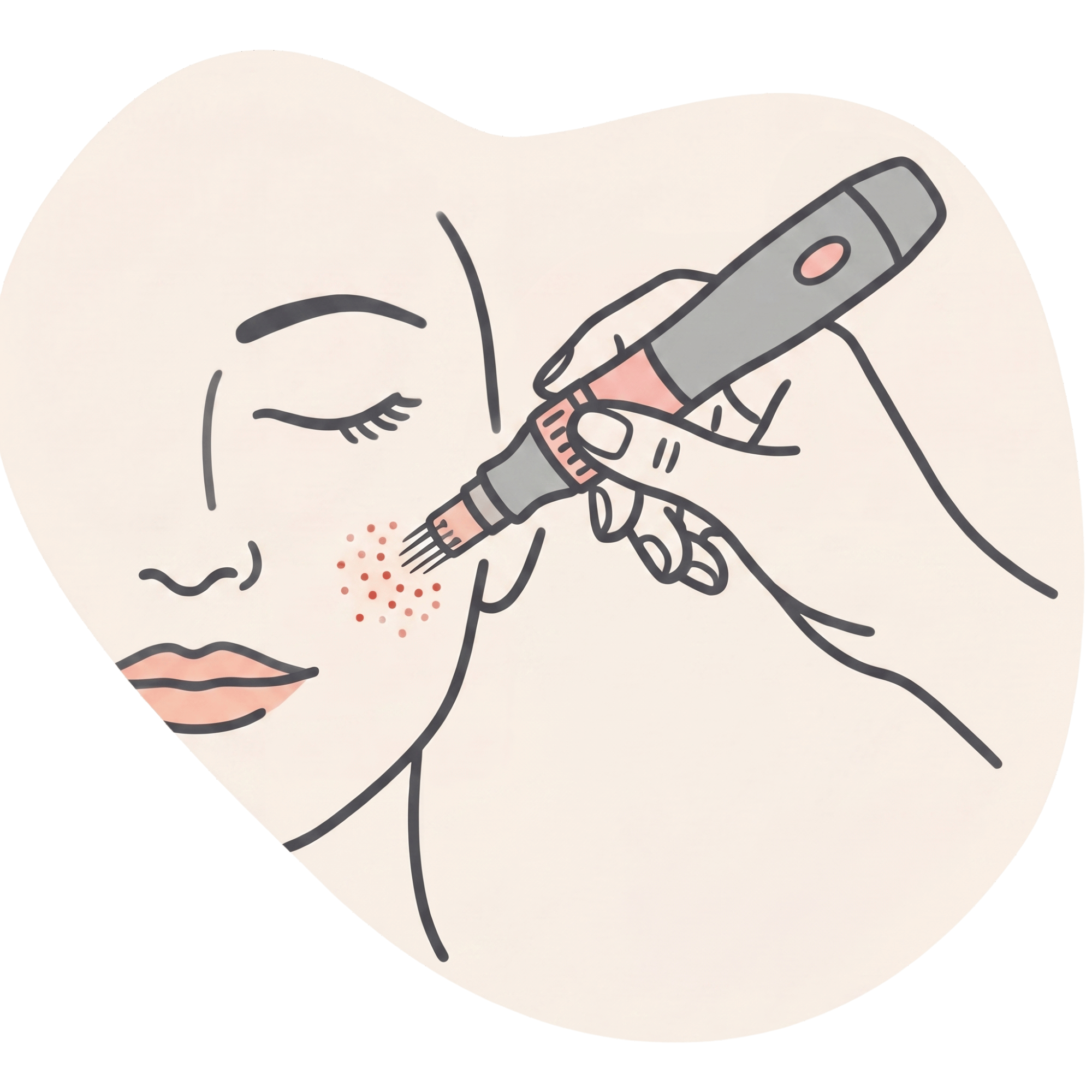 Kollagenstimulation zur Hautstraffung bei Humea Aesthetic in Köln